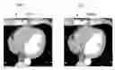 Fig. 01 - Image generation using machine learning
