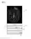 Fig. 04 - Method and system for visualizing a medical image data set
