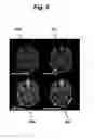 Fig. 07 - Contrast dose reduction for medical imaging using deep learning