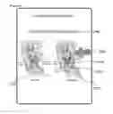 Fig. 11 - APPARATUS AND METHOD FOR ASSISTING MEDICAL CONSULTATION