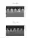 Fig. 14 - Method of etching substrate