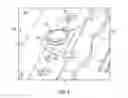 Fig. 06 - Molded air cavity packages and methods for the production thereof
