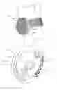 Fig. 01 - Antenna for appendage-worn miniature communications device