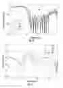 Fig. 08 - Collocated end-fire antenna and low-frequency antenna systems, devices, and methods