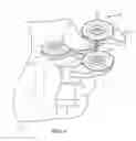 Fig. 04 - HANDHELD NEGATIVE ION GENERATION APPARATUS AND METHOD OF USE