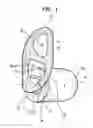 Fig. 02 - Earpiece intra-auricular support system