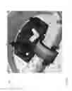 Fig. 09 - Printed circuit board (PCB) mount for headphone earcup