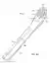 Fig. 08 - Eating utensil system