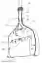 Fig. 08 - Brushing Device