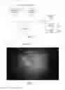 Fig. 03 - OCT-enabled injection for vitreoretinal surgery