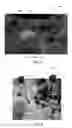 Fig. 06 - SYSTEMS AND METHODS FOR GUIDED INTERVENTIONAL PROCEDURES