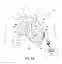 Fig. 02 - State-based atrial event detection