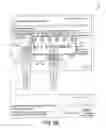 Fig. 07 - Systems and methods for surgical and interventional planning, support, post-operative follow-up, and functional recovery tracking