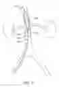 Fig. 08 - DEVICES AND METHODS FOR TREATING ACUTE KIDNEY INJURY