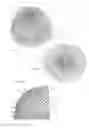 Fig. 08 - Occluding anatomical structures
