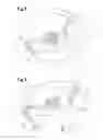 Fig. 06 - Vaginal positioner for uterine tamponade device and methods of using the same