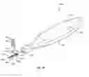 Fig. 02 - Systems and methods for implanting surgical implants