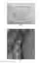 Fig. 02 - Radiopaque tissue marker