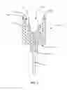 Fig. 06 - Identifying correct connections on a surgical console