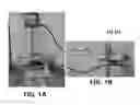 Fig. 02 - Method for debonding of orthodontic metal brackets with eugenol emulgel