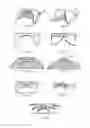 Fig. 06 - BIONIC IMPLANTS AND MANUFACTURING METHODS THEREOF
