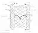 Fig. 01 - Heart valve repair and replacement