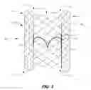 Fig. 04 - Heart valve repair and replacement