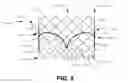 Fig. 06 - Heart valve repair and replacement