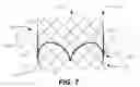 Fig. 08 - Heart valve repair and replacement