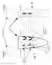 Fig. 02 - Load dissipating arthoplasty prostheses