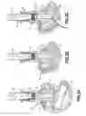 Fig. 03 - Device for gripping and inserting an insert element