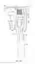 Fig. 35 - REVISION KNEE ARTHROPLASTY METHODS AND INSTRUMENTS