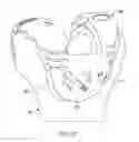 Fig. 45 - REVISION KNEE ARTHROPLASTY METHODS AND INSTRUMENTS