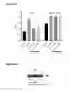 Fig. 43 - Method of treating ER mutant expressing breast cancers with selective androgen receptor modulators (SARMs)