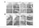 Fig. 07 - Method for remolding bone marrow microenvironment