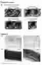 Fig. 08 - Methods and compositions for generating chondrocyte lineage cells and/or cartilage like tissue