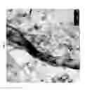 Fig. 02 - CARDIAC FIBROBLAST-DERIVED EXTRACELLULAR MATRIX AND INJECTABLE FORMULATIONS THEREOF FOR TREATMENT OF ISCHEMIC DISEASE OR INJURY