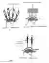 Fig. 06 - System for achieving high-specificity killing of targeted cells and method thereof using magneto-electric nano-particles