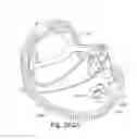 Fig. 89 - Delivery of respiratory therapy
