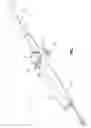 Fig. 02 - Tension adjustment for steering actuator for deflectable catheter