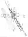 Fig. 03 - Tension adjustment for steering actuator for deflectable catheter