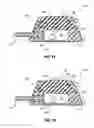 Fig. 09 - Assemblies for identifying a power injectable access port