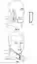 Fig. 09 - SYSTEMS AND METHODS FOR INITIAL PROVISIONING AND REFILLING OF MEDICAL DEVICES