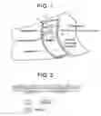 Fig. 02 - Methods of using an integrated surface stimulation device for wound therapy and infection control