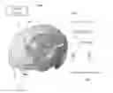 Fig. 01 - SYSTEMS AND METHODS OF TREATING A NEUROLOGICAL DISORDER IN A PATIENT