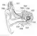 Fig. 01 - Optical Proximity Sensing System For Atraumatic Cochlea Implant Surgery