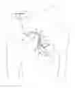 Fig. 01 - Bundle branch pacing devices and methods