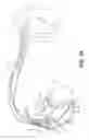 Fig. 05 - Bundle branch pacing devices and methods