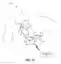 Fig. 17 - Bundle branch pacing devices and methods