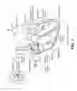 Fig. 02 - Leadless pacing device for His bundle and bundle branch pacing
